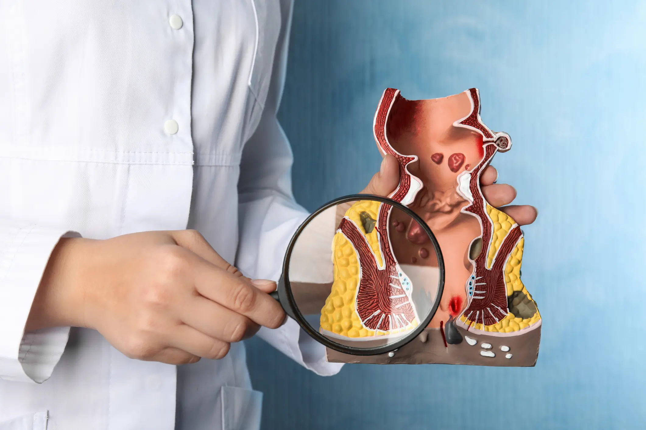 Diagn&oacute;stico m&eacute;dico com modelo anat&oacute;mico